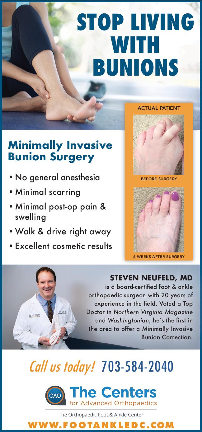 Minimally Invasive Bunion Surgery The Orthopaedic Foot & Ankle Center