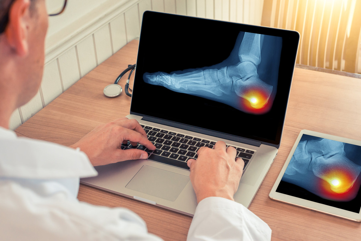 What To Expect From Heel Spur Surgery The Orthopaedic Foot & Ankle Center