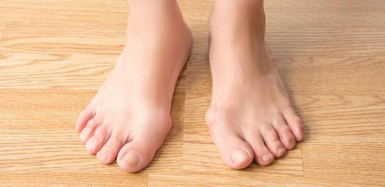 Swollen Big Toe: Causes, Symptoms, and Treatment Options