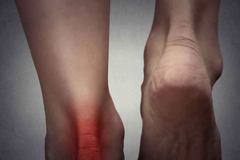Heel Injuries | Heel Disorders | MedlinePlus